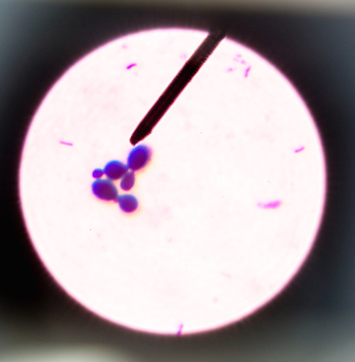 Budding yeast cells in sputum gram stain fine with Microscope 100x.